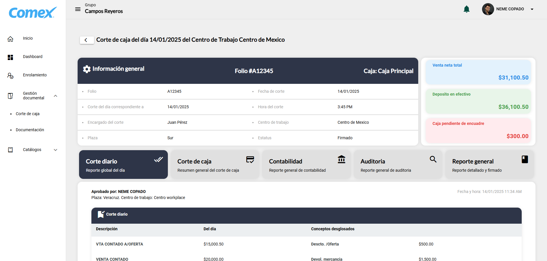 Sistema de estampado 3